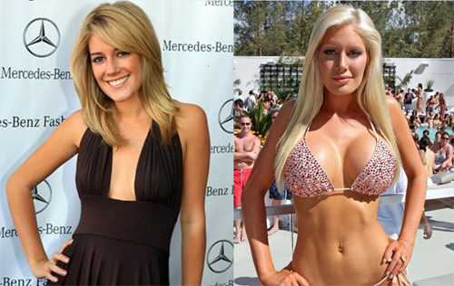 HeidiMontag Plastic Surgery is one hell of a drug.